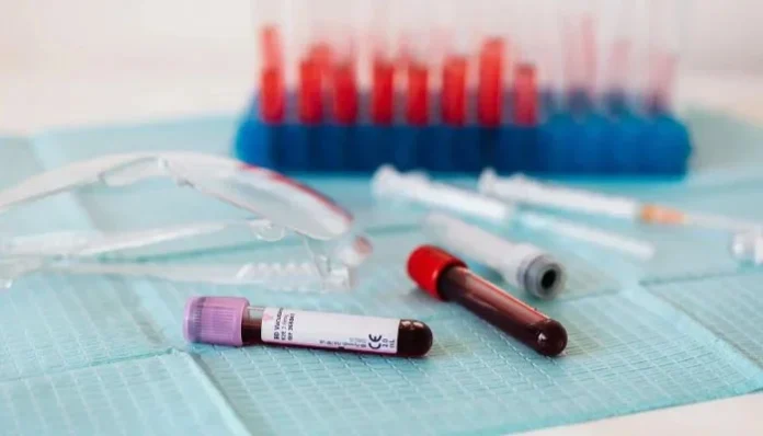 French researchers identify a new blood type in woman from Guadeloupe
