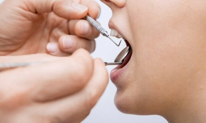 Experts develop AI tool to detect dental issues